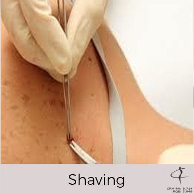 Shaving
